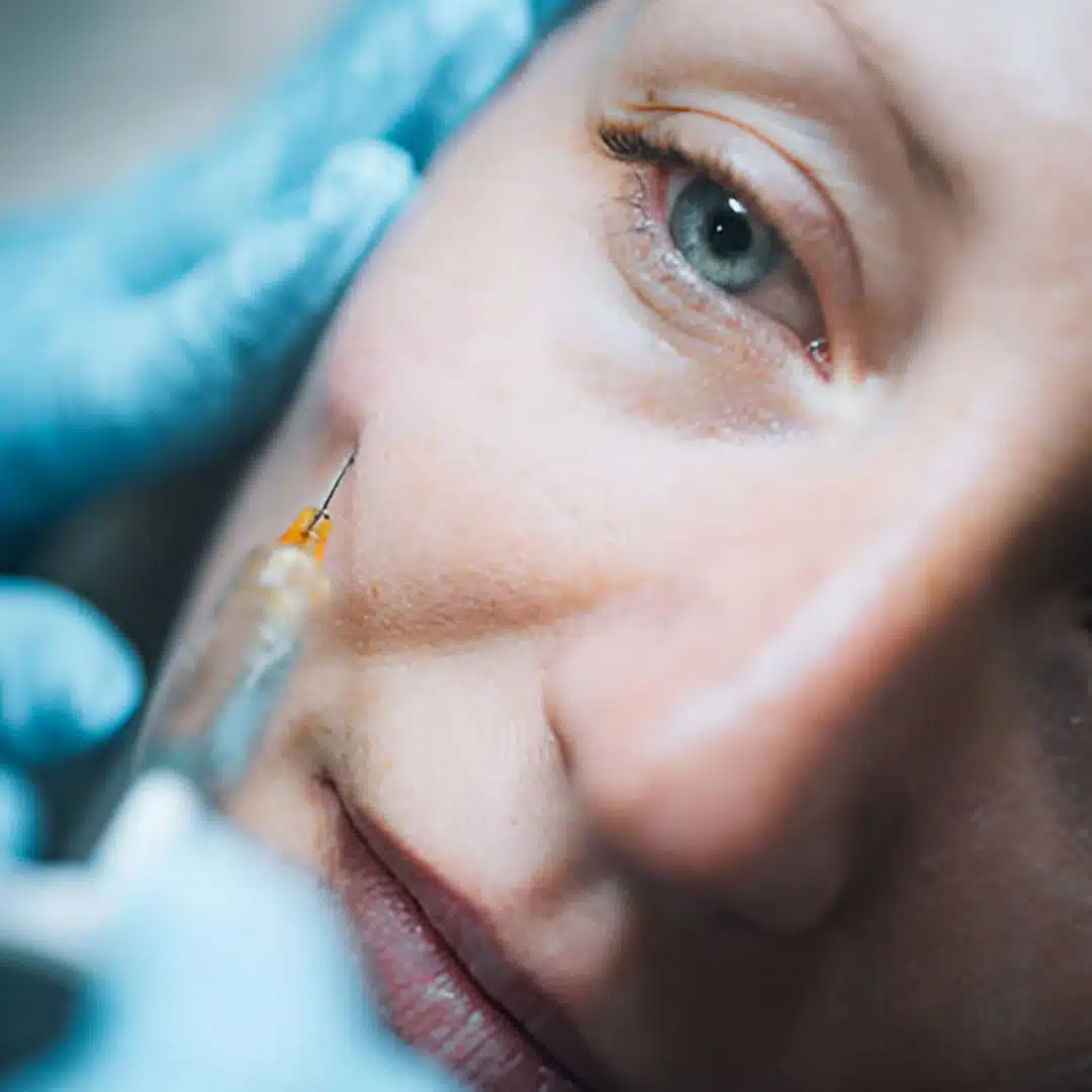 derma fillers1