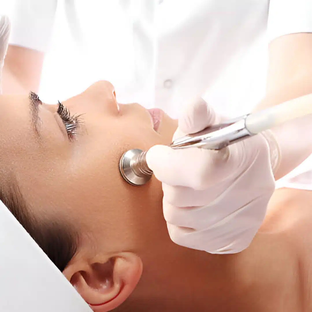 dermaplaning2