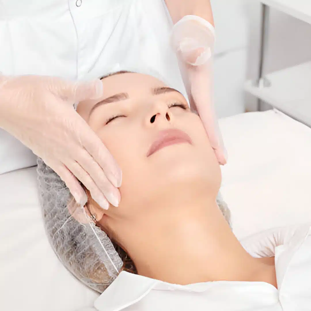 ipl photofacial3