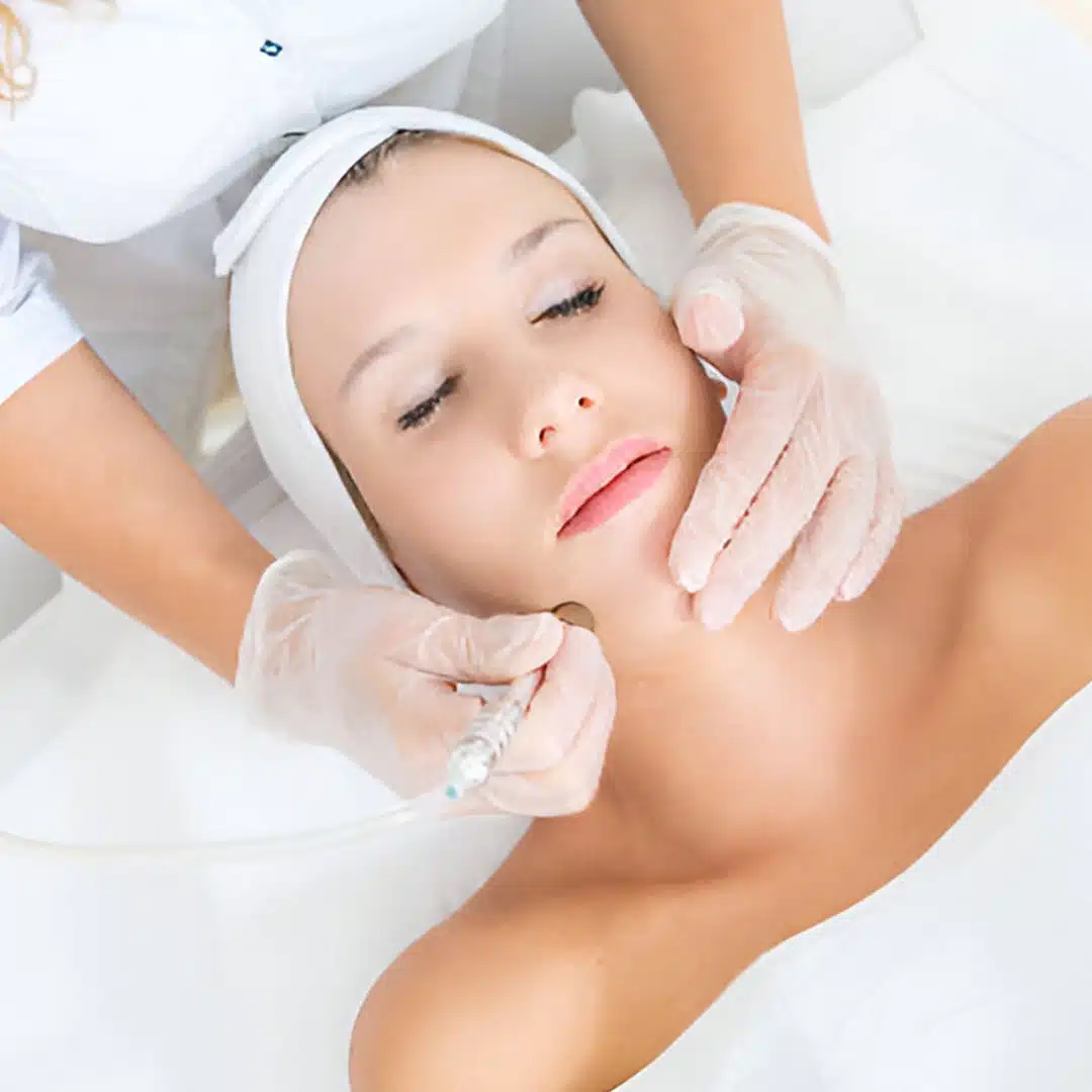 microdermabrasion2