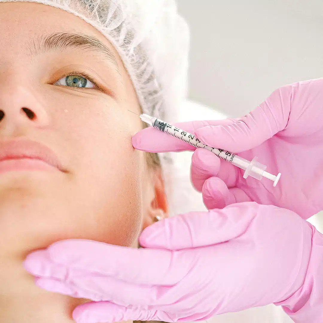 botox1